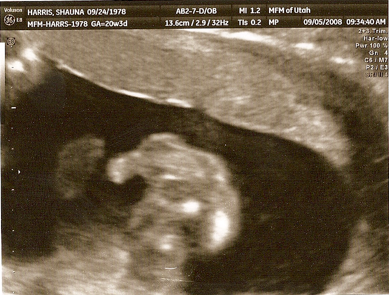 William (Liam) Fox Harris